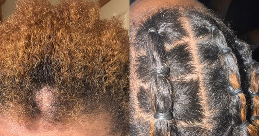 How to Regrow Thinning Edges Naturally